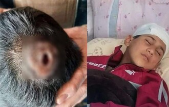 تربية صلاح الدين: سحب يد معلم ضرب تلميذا بالخاتم وثقب جمجمته