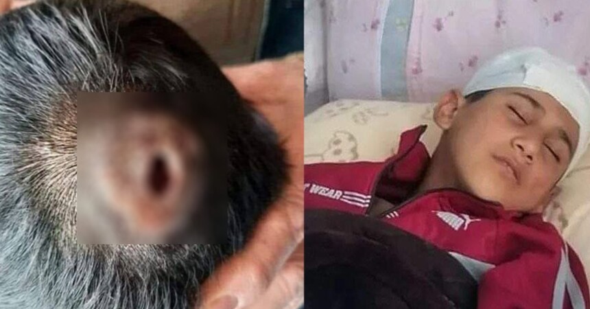 تربية صلاح الدين: سحب يد معلم ضرب تلميذا بالخاتم وثقب جمجمته